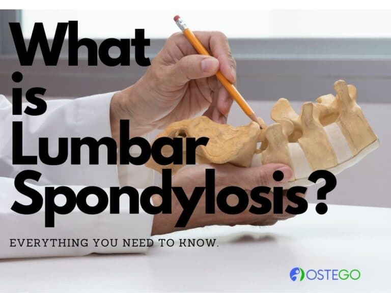 What Is Lumbar Spondylosis? Why Does It Occur? - Ostego